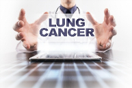 Illustration lung cancer